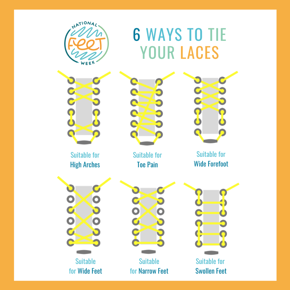 laces