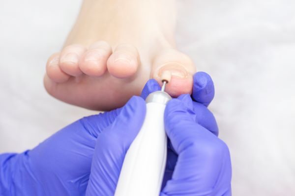 foot being treated
